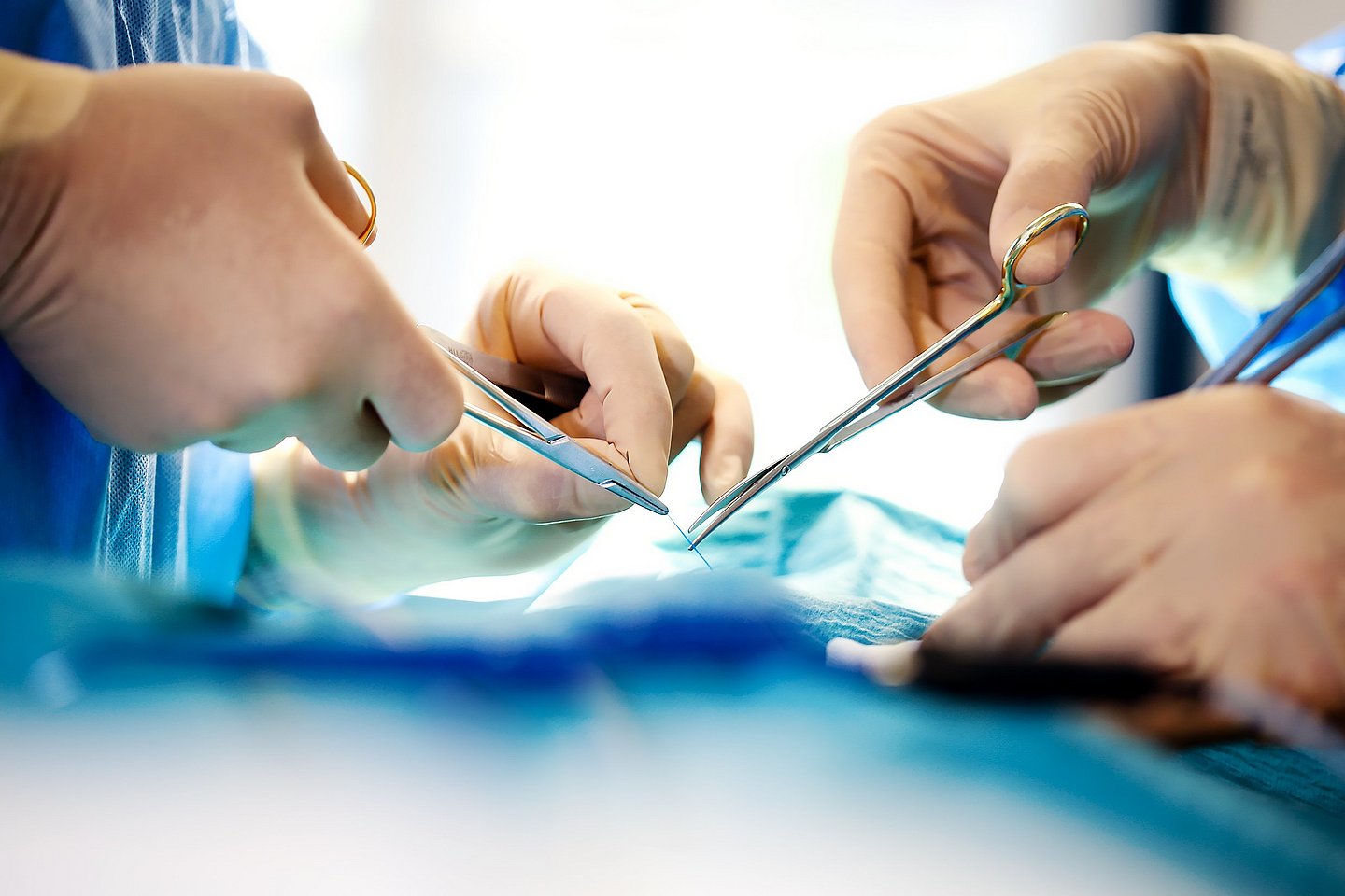 Mitral valve surgery