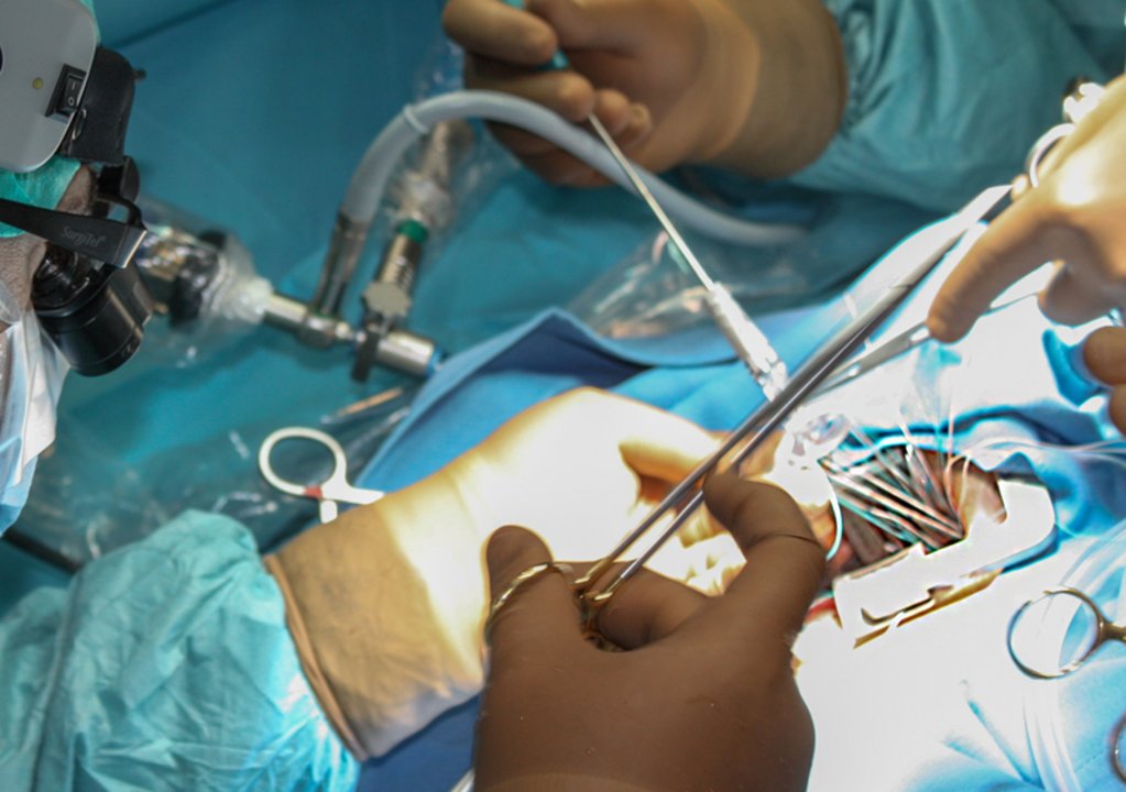 Less is more: Minimally invasive procedures facilitate complex heart operations